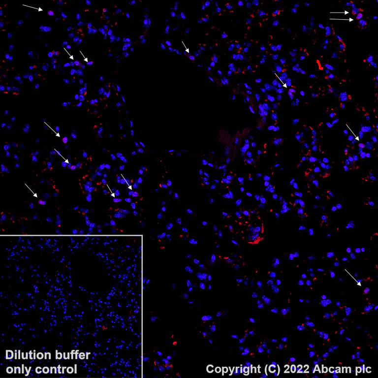 Immunohistochemistry (Formalin/PFA-fixed paraffin-embedded sections) - Alexa Fluor® 594 Anti-Ly6g antibody [EPR22909-135] (AB307167)