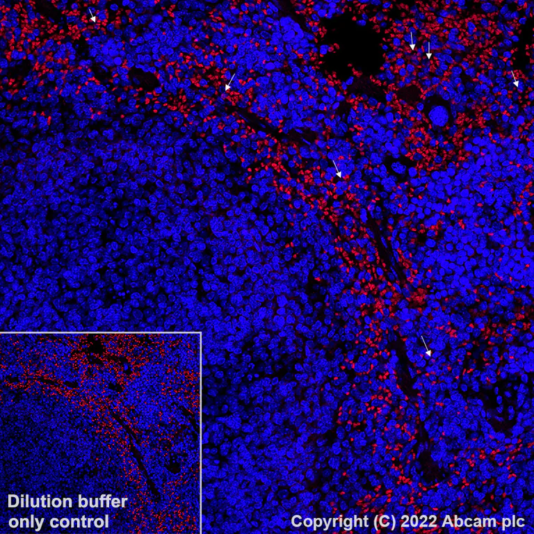 Immunohistochemistry (Formalin/PFA-fixed paraffin-embedded sections) - Alexa Fluor® 594 Anti-Ly6g antibody [EPR22909-135] (AB307167)