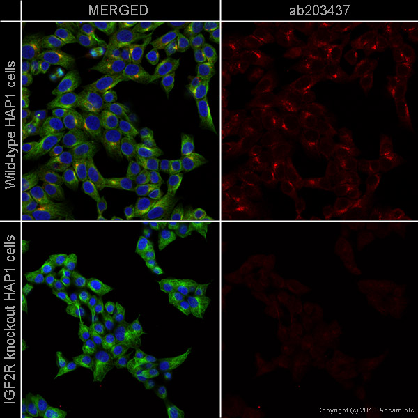 Immunocytochemistry/ Immunofluorescence - Alexa Fluor® 594 Anti-M6PR (cation independent) antibody [EPR6599] - Lysosome Membrane Marker (AB203437)