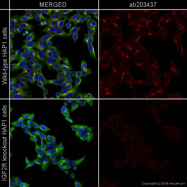 Immunocytochemistry/ Immunofluorescence - Alexa Fluor® 594 Anti-M6PR (cation independent) antibody [EPR6599] - Lysosome Membrane Marker (AB203437)