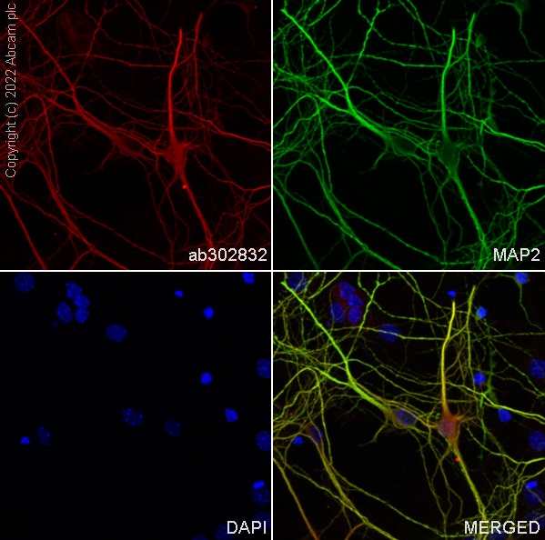 Immunocytochemistry/ Immunofluorescence - Alexa Fluor® 594 Anti-MAP2 antibody [EPR19691] - Neuronal Marker (AB302832), expandable thumbnail