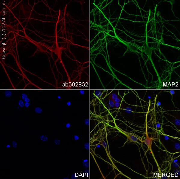 Immunocytochemistry/ Immunofluorescence - Alexa Fluor® 594 Anti-MAP2 antibody [EPR19691] - Neuronal Marker (AB302832)