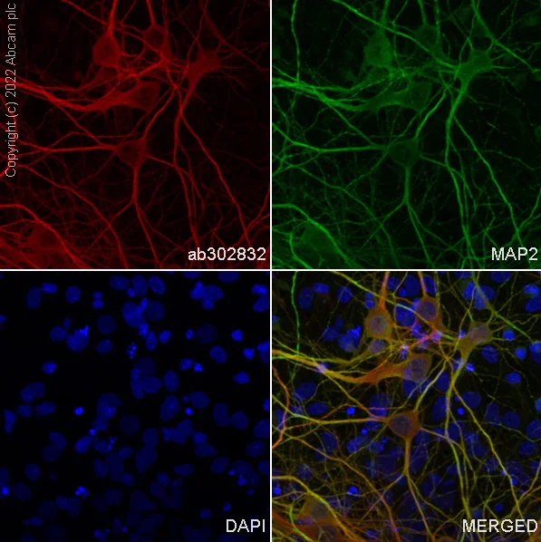 Immunocytochemistry/ Immunofluorescence - Alexa Fluor® 594 Anti-MAP2 antibody [EPR19691] - Neuronal Marker (AB302832)