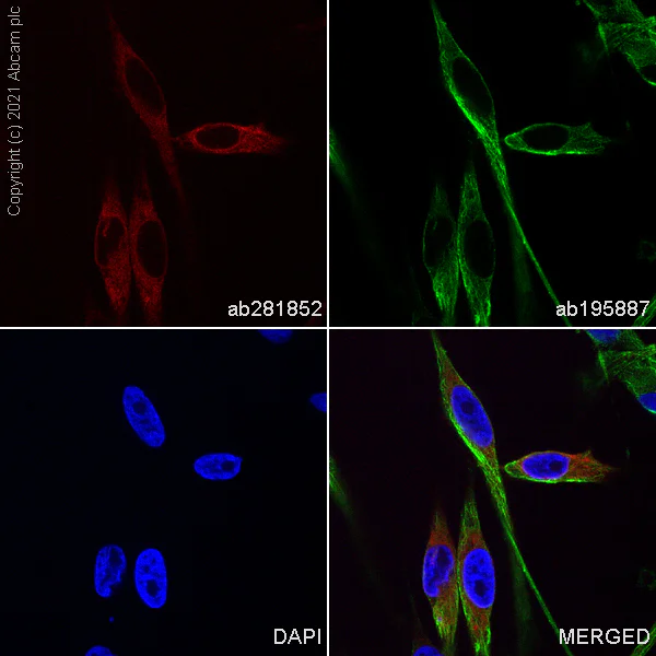 Immunocytochemistry/ Immunofluorescence - Alexa Fluor® 594 Anti-MelanA antibody [EP1422Y] (AB281852)