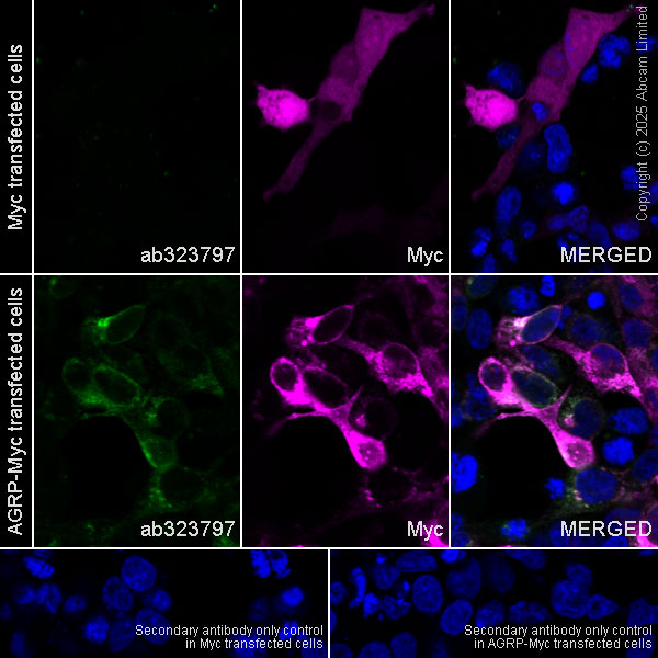 Immunocytochemistry/ Immunofluorescence - Alexa Fluor® 594 Anti-Myc tag antibody [9E10] (AB223894), expandable thumbnail