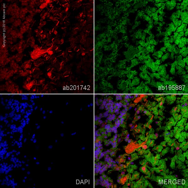 Immunohistochemistry (Frozen sections) - Alexa Fluor® 594 Anti-NCAM1 antibody [EPR2566] (AB201742)