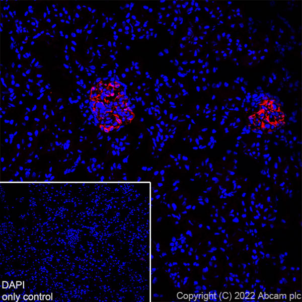 Immunohistochemistry (Frozen sections) - Alexa Fluor® 594 Anti-Nestin antibody [EPR22023] (AB307624), expandable thumbnail