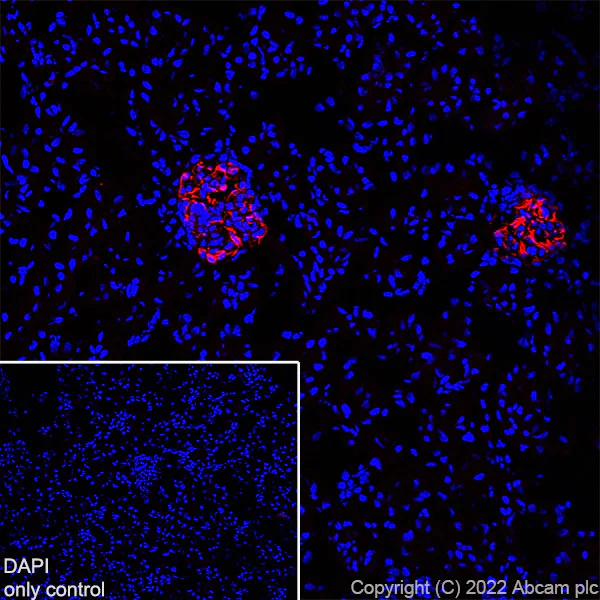 Immunohistochemistry (Frozen sections) - Alexa Fluor® 594 Anti-Nestin antibody [EPR22023] - Neural Stem Cell Marker (AB307624)