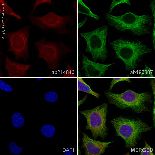 Immunocytochemistry/ Immunofluorescence - Alexa Fluor® 594 Anti-NF-kB p65 antibody [E379] (AB214846)
