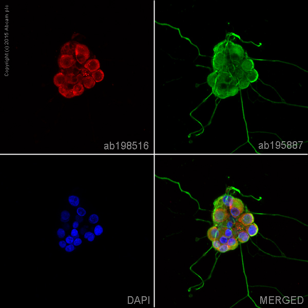 Immunocytochemistry/ Immunofluorescence - Alexa Fluor® 594 Anti-nNOS (neuronal) antibody [EP1855Y] (AB198516)
