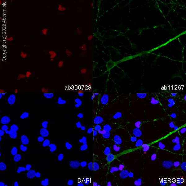 Immunocytochemistry/ Immunofluorescence - Alexa Fluor® 594 Anti-Olig2 antibody [EPR2673] (AB300729)
