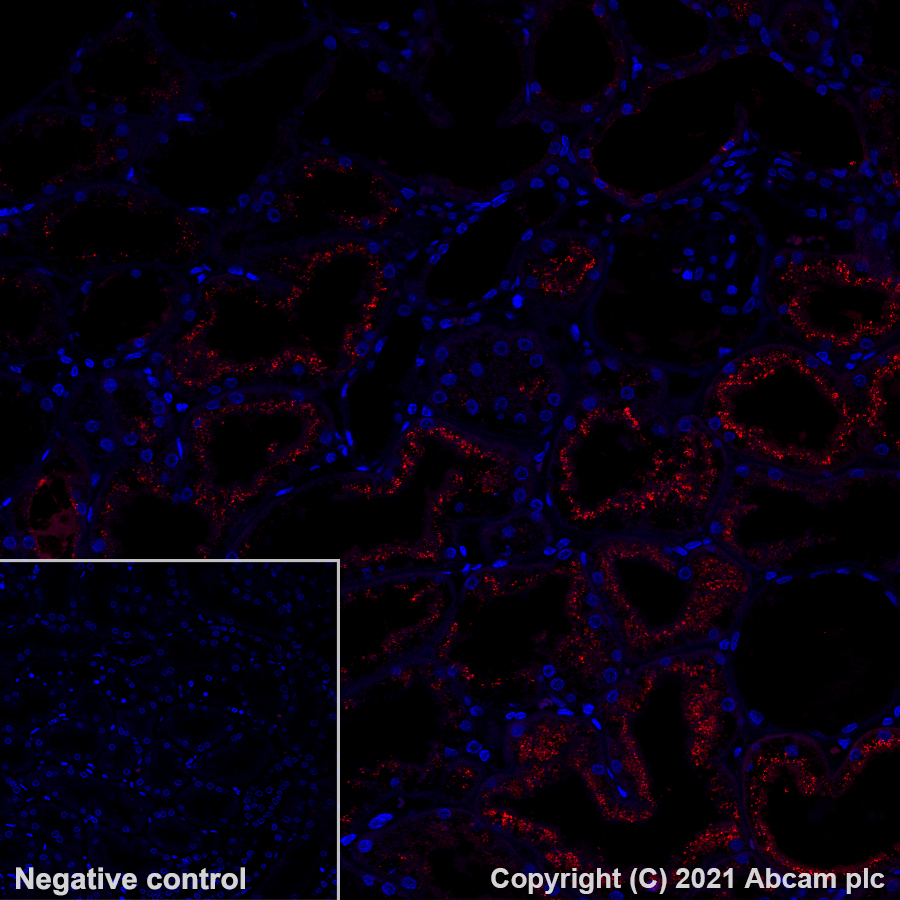 Immunohistochemistry (Formalin/PFA-fixed paraffin-embedded sections) - Alexa Fluor® 594 Anti-Osteopontin antibody [EPR21139-316] (AB282279), expandable thumbnail