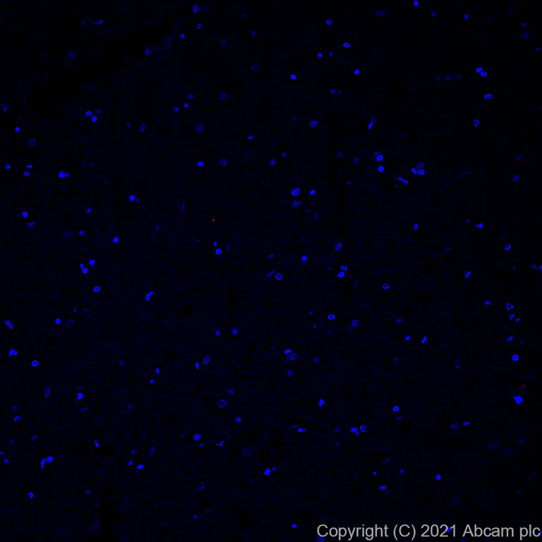 Immunohistochemistry (Formalin/PFA-fixed paraffin-embedded sections) - Alexa Fluor® 594 Anti-Osteopontin antibody [EPR21139-316] (AB282279)