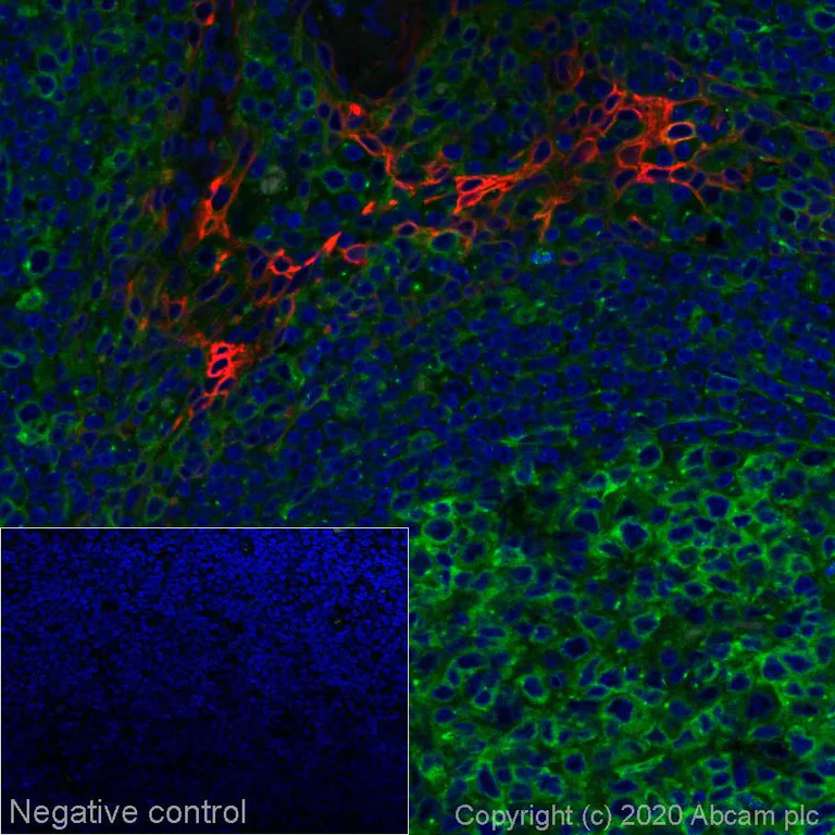 Immunohistochemistry (Formalin/PFA-fixed paraffin-embedded sections) - Alexa Fluor® 594 Anti-pan Cytokeratin antibody [C-11] (AB277234)