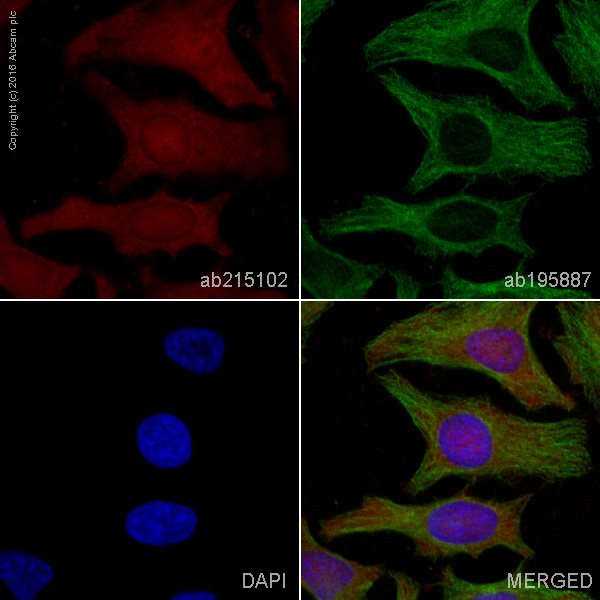 Immunocytochemistry/ Immunofluorescence - Alexa Fluor® 594 Anti-PARK7/DJ1 antibody [EP2815Y] (AB215102)