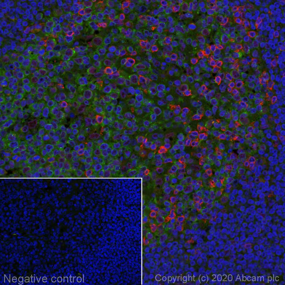 Immunohistochemistry (Formalin/PFA-fixed paraffin-embedded sections) - Alexa Fluor® 594 Anti-PD1 antibody [EPR4877(2)] (AB275349), expandable thumbnail