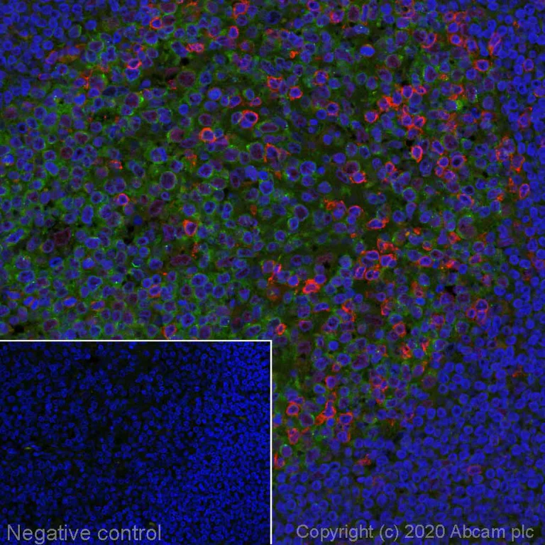 Immunohistochemistry (Formalin/PFA-fixed paraffin-embedded sections) - Alexa Fluor® 594 Anti-PD1 antibody [EPR4877(2)] (AB275349)