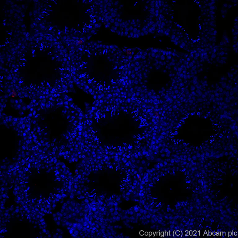 Immunohistochemistry (Formalin/PFA-fixed paraffin-embedded sections) - Alexa Fluor® 594 Anti-PF4 antibody [EPR7763] (AB282001)
