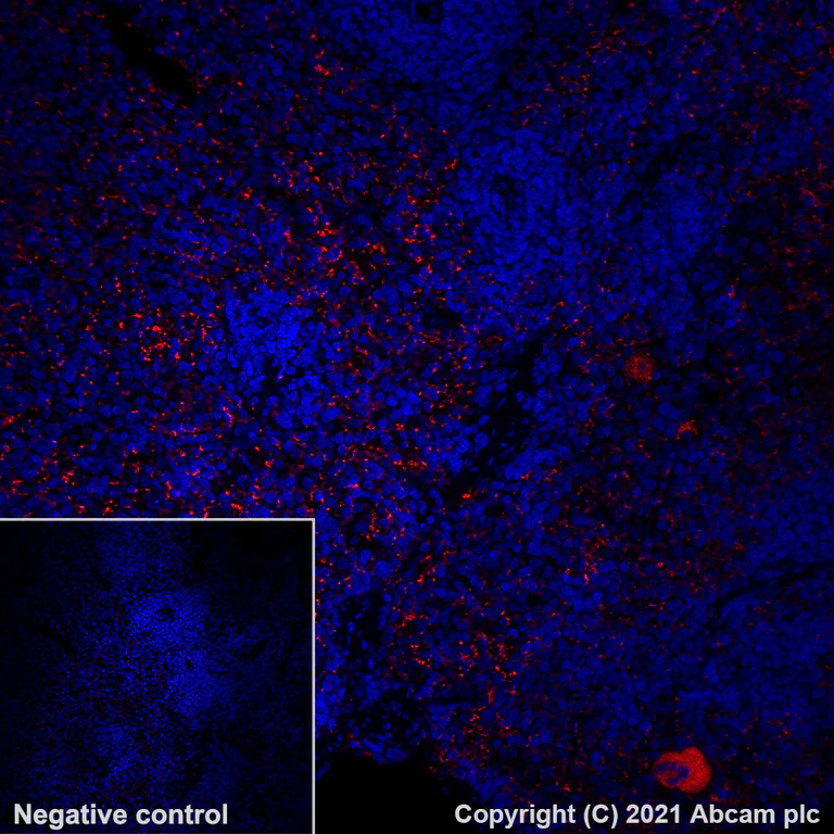 Immunohistochemistry (Formalin/PFA-fixed paraffin-embedded sections) - Alexa Fluor® 594 Anti-PF4 antibody [EPR7763] (AB282001)