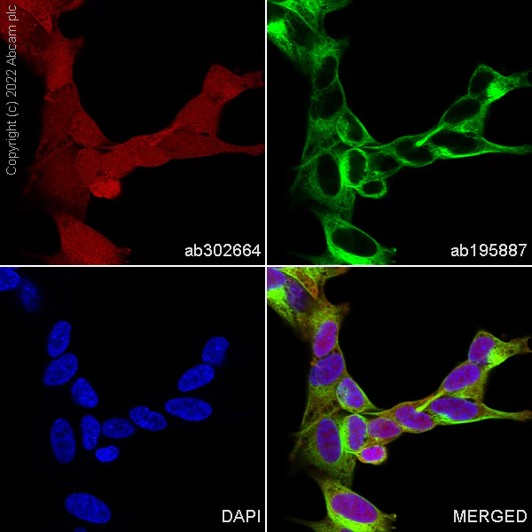 Immunocytochemistry/ Immunofluorescence - Alexa Fluor® 594 Anti-PGP9.5 antibody [EPR4118] - Neuronal Marker (AB302664)