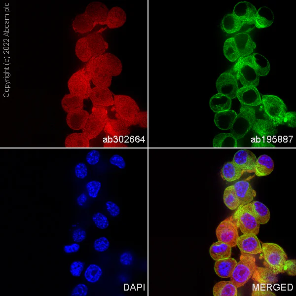 Immunocytochemistry/ Immunofluorescence - Alexa Fluor® 594 Anti-PGP9.5 antibody [EPR4118] - Neuronal Marker (AB302664)