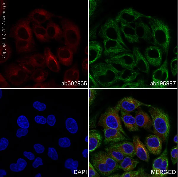 Immunocytochemistry/ Immunofluorescence - Alexa Fluor® 594 Anti-RAB10 antibody [MJF-R23] (AB302835)