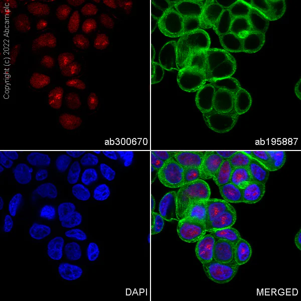 Immunocytochemistry/ Immunofluorescence - Alexa Fluor® 594 Anti-Rb antibody [EPR17512] (AB300670)