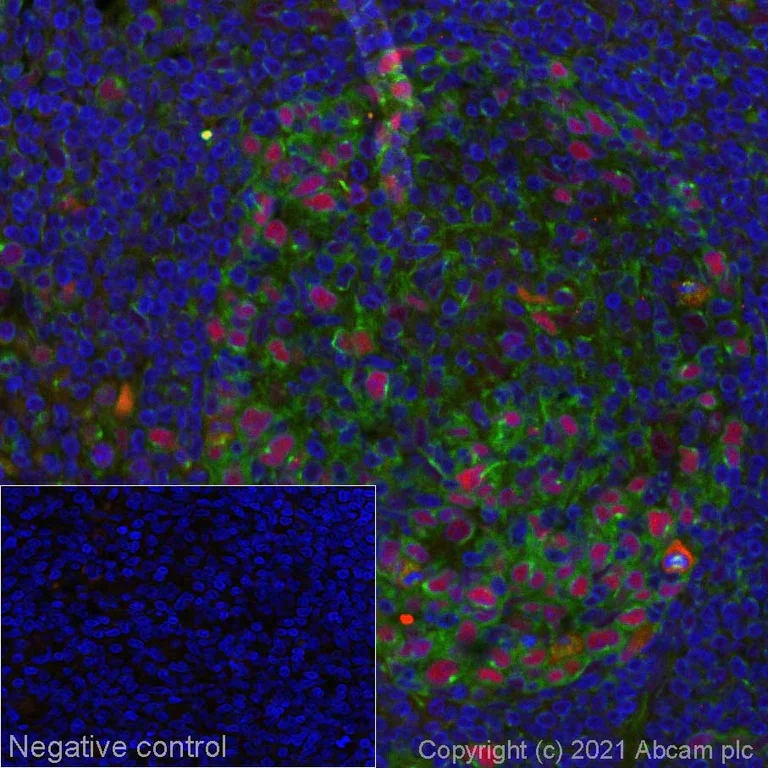 Immunohistochemistry (Formalin/PFA-fixed paraffin-embedded sections) - Alexa Fluor® 594 Anti-Rb (phospho S807) antibody [EPR17732] (AB277935)