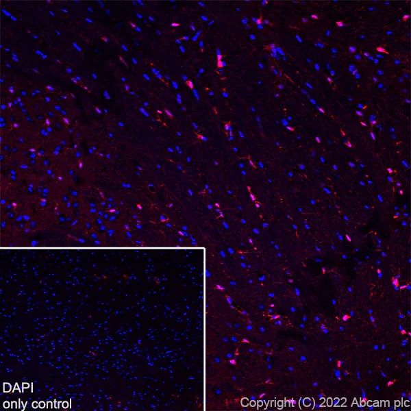 Immunohistochemistry (Frozen sections) - Alexa Fluor® 594 Anti-S100 beta antibody [EP1576Y] - Astrocyte Marker (AB307851)