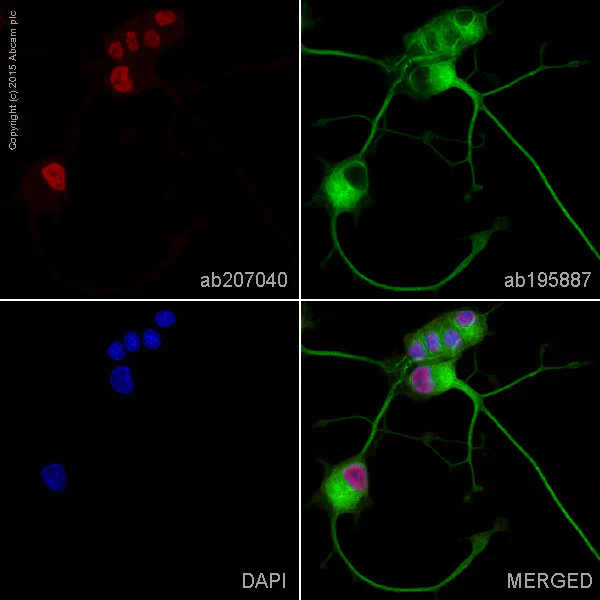 Immunocytochemistry/ Immunofluorescence - Alexa Fluor® 594 Anti-SATB2 antibody [EPNCIR130A] (AB207040)