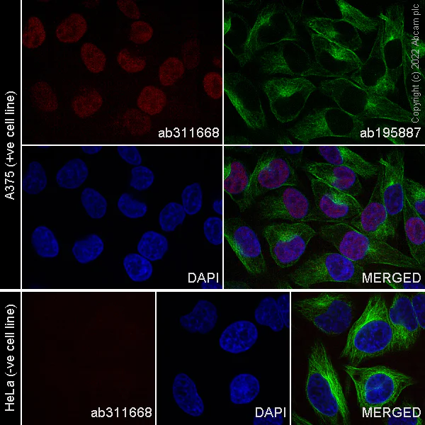 Immunocytochemistry/ Immunofluorescence - Alexa Fluor® 594 Anti-SOX10 antibody [SP267] (AB311668)