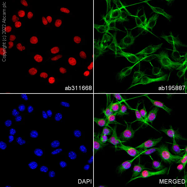 Immunocytochemistry/ Immunofluorescence - Alexa Fluor® 594 Anti-SOX10 antibody [SP267] (AB311668)