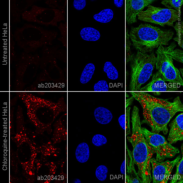 Immunocytochemistry/ Immunofluorescence - Alexa Fluor® 594 Anti-SQSTM1 / p62 antibody [EPR4844] - Autophagosome Marker (AB203429)