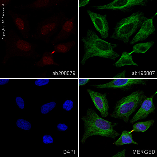 Immunocytochemistry/ Immunofluorescence - Alexa Fluor® 594 Anti-Survivin antibody [EP2880Y] (AB207879)