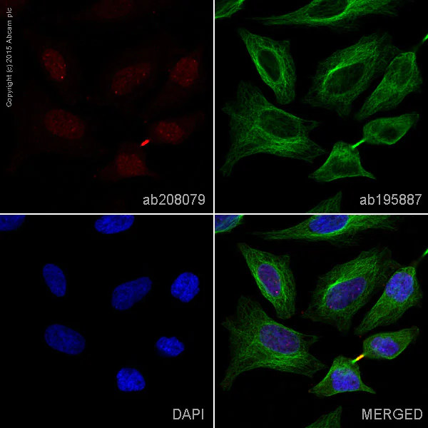 Immunocytochemistry/ Immunofluorescence - Alexa Fluor® 594 Anti-Survivin antibody [EP2880Y] (AB207879)