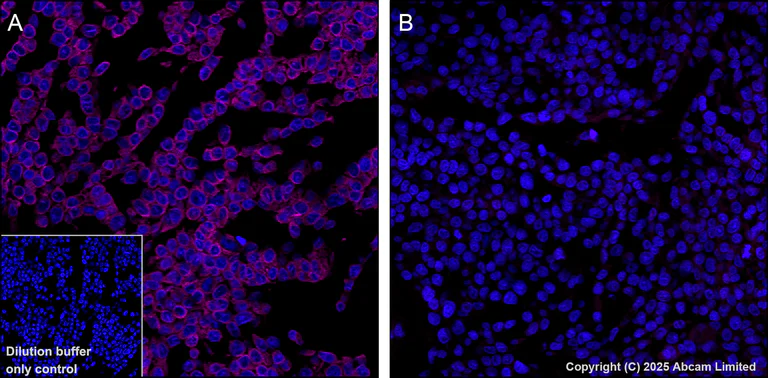 Immunohistochemistry (Formalin/PFA-fixed paraffin-embedded sections) - Alexa Fluor® 594 Anti-TAP1 antibody [EPR26236-92] (AB325703)