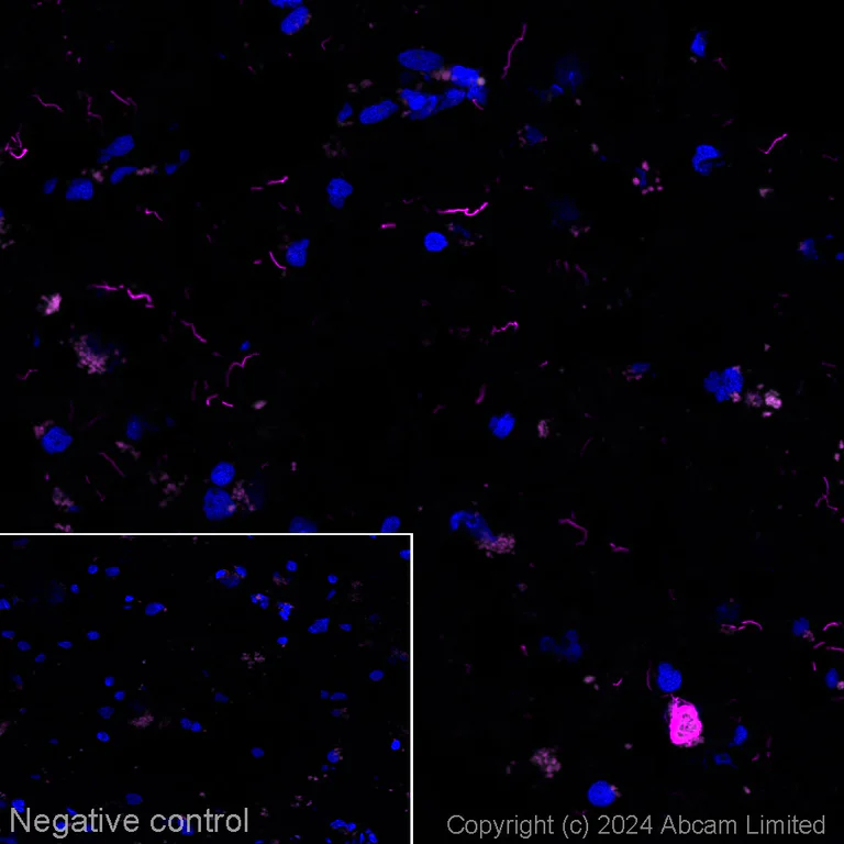 Immunohistochemistry (Frozen sections) - Alexa Fluor® 594 Anti-Tau Alzheimer’s Disease antibody [GT-38] - Conformation-Specific (AB317763)