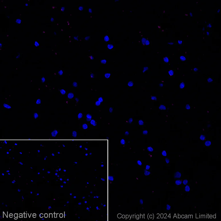 Immunohistochemistry (Frozen sections) - Alexa Fluor® 594 Anti-Tau Alzheimer’s Disease antibody [GT-38] - Conformation-Specific (AB317763)