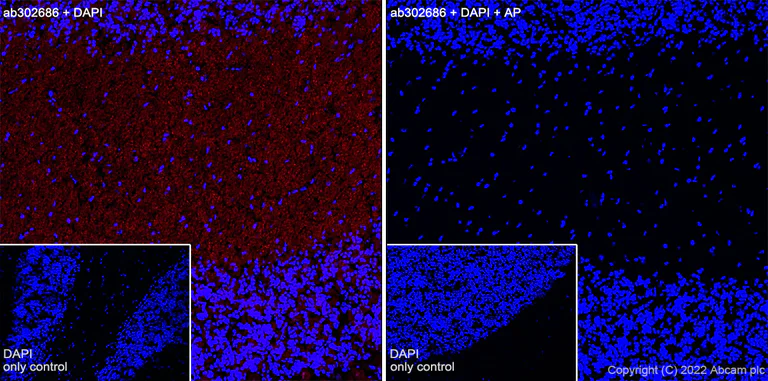 Immunohistochemistry (Frozen sections) - Alexa Fluor® 594 Anti-Tau (phospho S396) antibody [EPR2731] (AB302686)