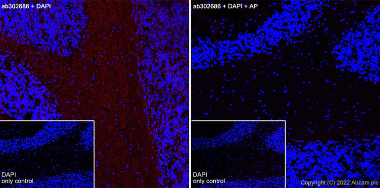 Immunohistochemistry (Frozen sections) - Alexa Fluor® 594 Anti-Tau (phospho S396) antibody [EPR2731] (AB302686)
