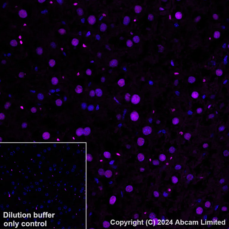 Immunohistochemistry (Formalin/PFA-fixed paraffin-embedded sections) - Alexa Fluor® 594 Anti-Transaldolase 1 antibody [EPR28140-51] (AB323464)