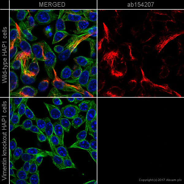 Immunocytochemistry/ Immunofluorescence - Alexa Fluor® 594 Anti-Vimentin antibody [EPR3776] - Cytoskeleton Marker (AB154207)