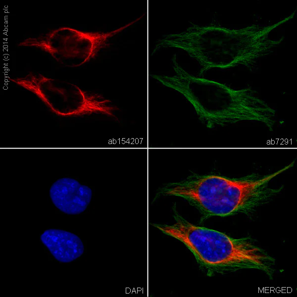 Immunocytochemistry/ Immunofluorescence - Alexa Fluor® 594 Anti-Vimentin antibody [EPR3776] - Cytoskeleton Marker (AB154207)