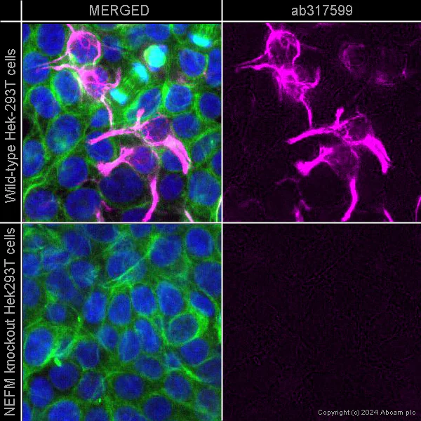 Immunocytochemistry/ Immunofluorescence - Alexa Fluor® 647 Anti-160 kD Neurofilament Medium antibody [EPR23510-76] - Neuronal Marker (AB317599)