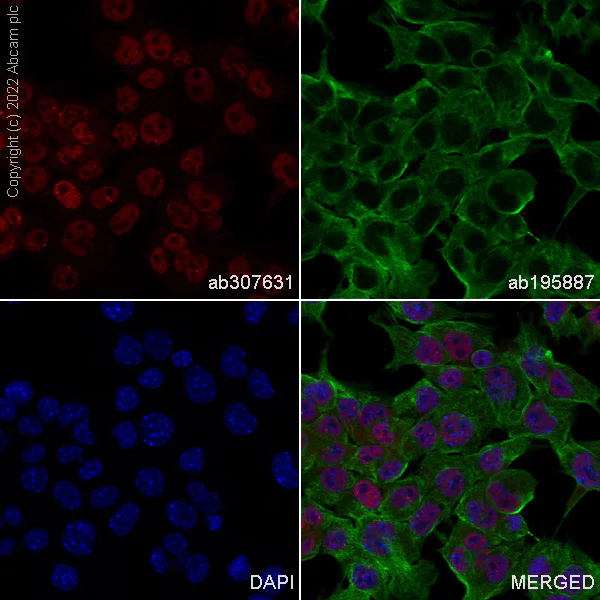 Immunocytochemistry/ Immunofluorescence - Alexa Fluor® 647 Anti-53BP1 antibody [EPR2172(2)] (AB307631)