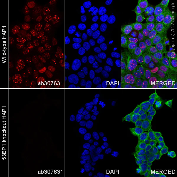 Immunocytochemistry/ Immunofluorescence - Alexa Fluor® 647 Anti-53BP1 antibody [EPR2172(2)] (AB307631)