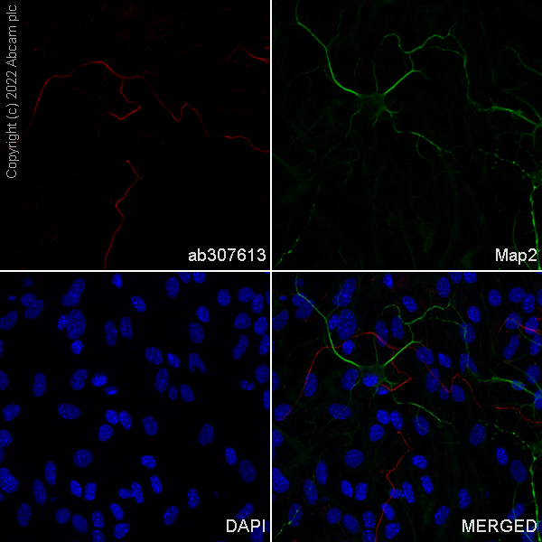 Immunocytochemistry/ Immunofluorescence - Alexa Fluor® 647 Anti-68kDa Neurofilament/NF-L antibody [EPR22035-112] (AB307613), expandable thumbnail