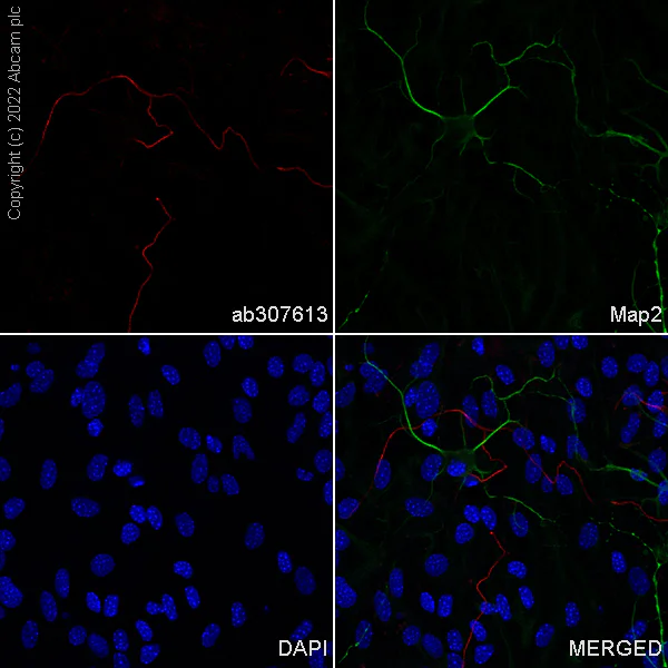 Immunocytochemistry/ Immunofluorescence - Alexa Fluor® 647 Anti-68kDa Neurofilament/NF-L antibody [EPR22035-112] (AB307613)