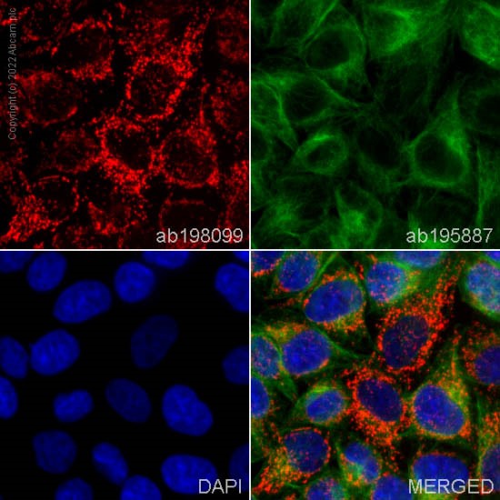 Immunocytochemistry/ Immunofluorescence - Alexa Fluor® 647 Anti-ACADM/MCAD antibody [3B7BH7] (AB198099)