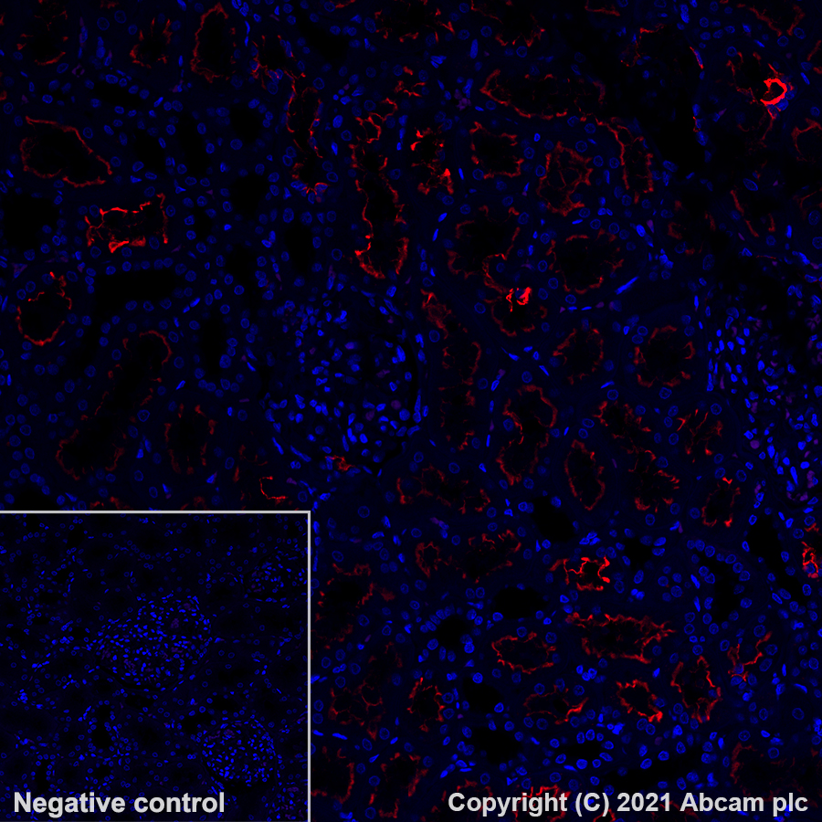 Immunohistochemistry (Formalin/PFA-fixed paraffin-embedded sections) - Alexa Fluor® 647 Anti-ACE2 antibody [EPR24705-45] (AB283658), expandable thumbnail